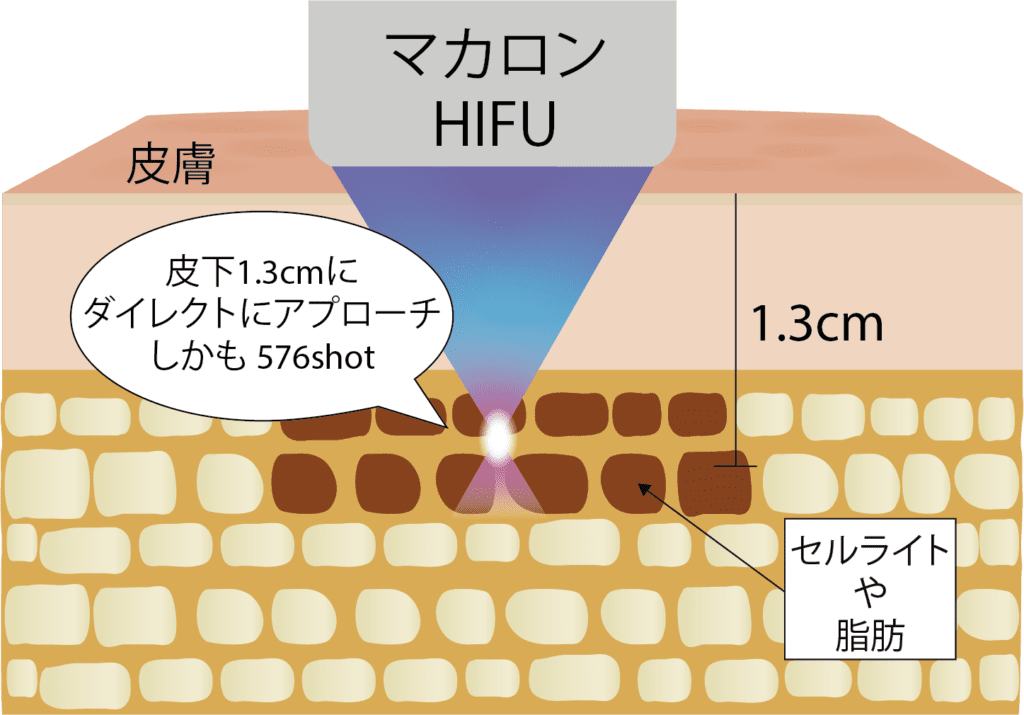 マカロンハイフ