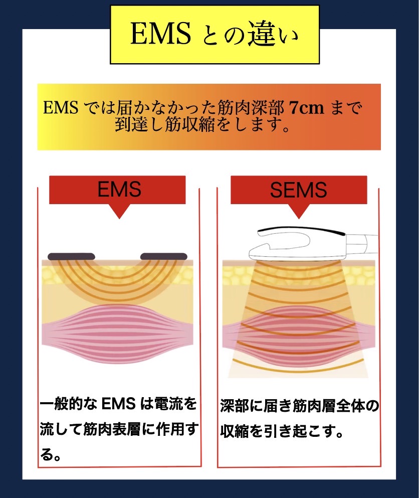 EMSとの違い