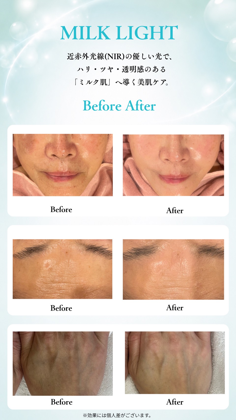 施術の Before After（ビフォーアフター）
