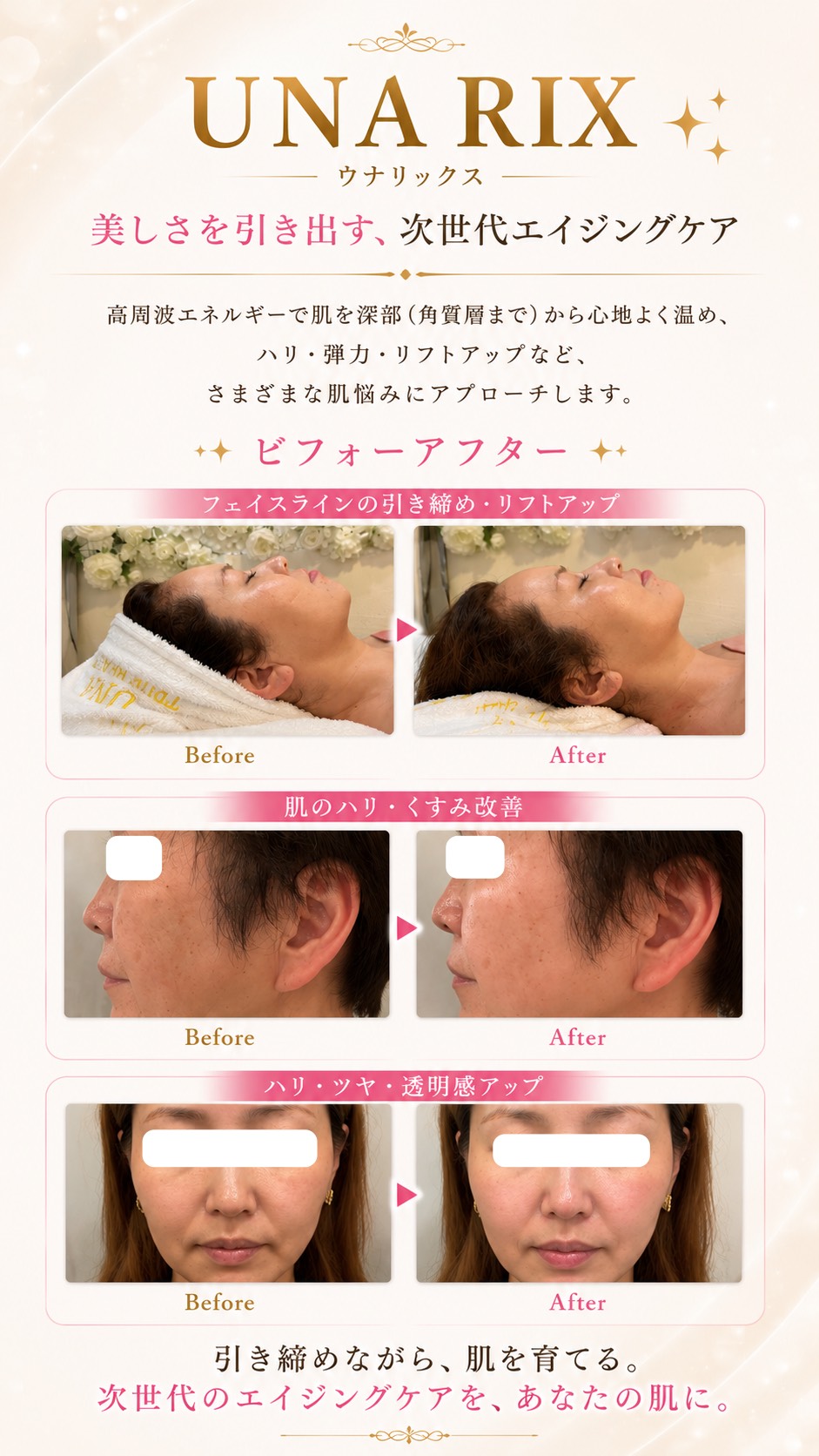 施術のビフォーアフター（フェイスライン・ハリ・ツヤ改善）
