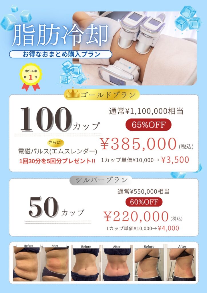 UNA脂肪冷却 新痩身技術｜UNA True Beauty エステサロン