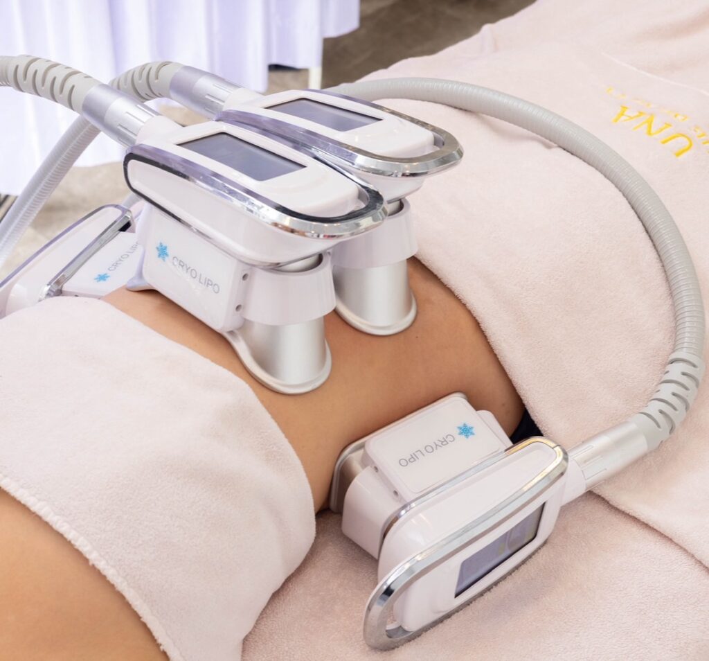 脂肪冷却マシン