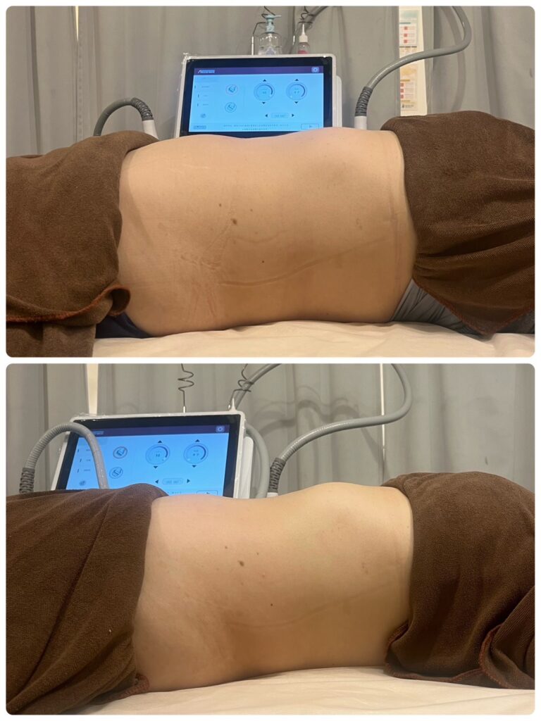 オンダプロフェッショナルビフォーアフター