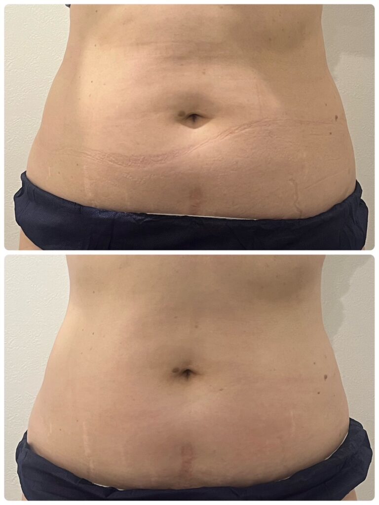 オンダプロフェッショナルビフォーアフター