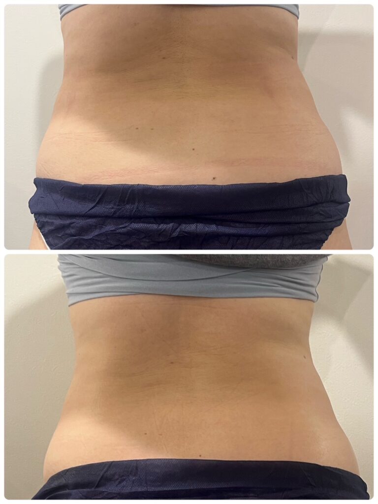 オンダプロフェッショナルビフォーアフター