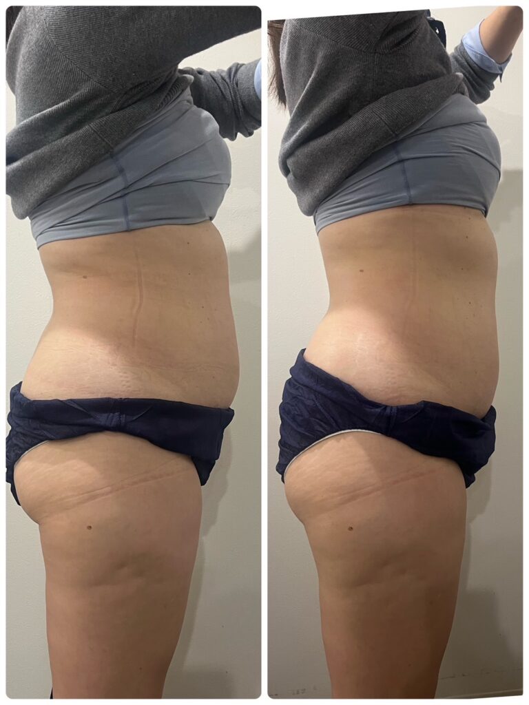 オンダプロフェッショナルビフォーアフター